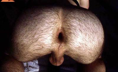 xpics ass - gapinghole 08