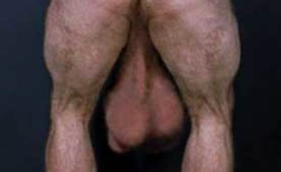 xpics dick - abnorm