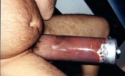 xpics pump - bullpumper